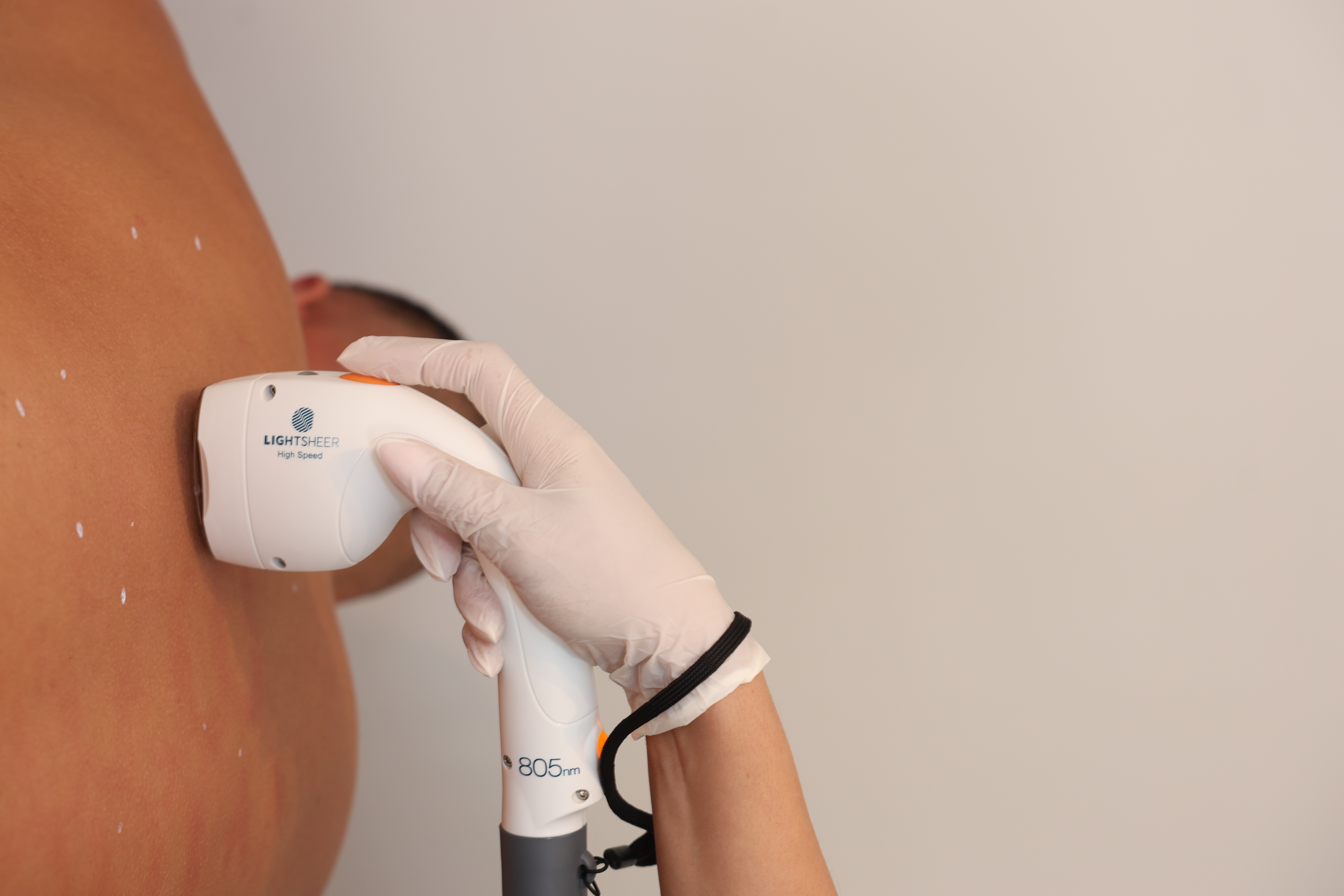 Laser Treatment Benefits